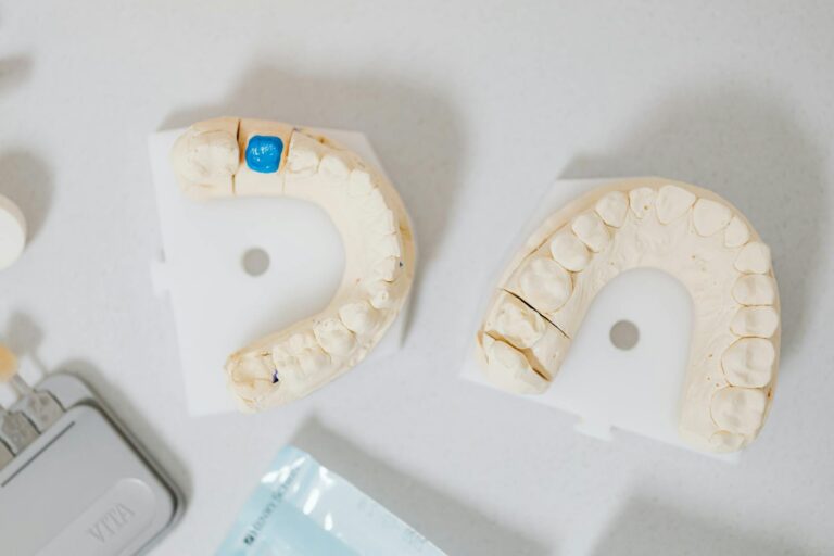 Close-up of dental molds on a white table, showcasing orthodontic details.