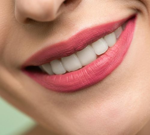Vivid close-up image of a woman's smile showcasing red lipstick and white teeth on a light background.