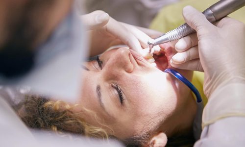 Close-up of a dental procedure with dentist and patient in a clinic setting.