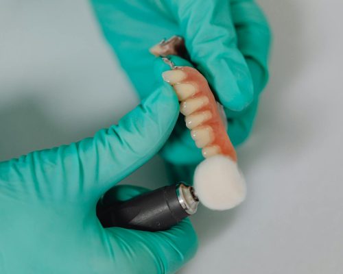 Detailed view of a dentist polishing dental implants with precision, showcasing professional dental care.