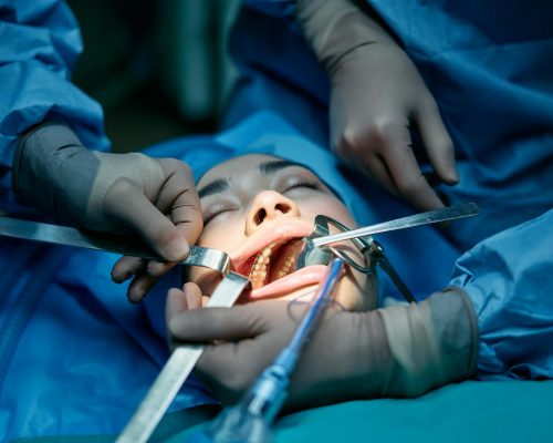 Medical professionals conducting dental surgery on a patient in a clinic setting.
